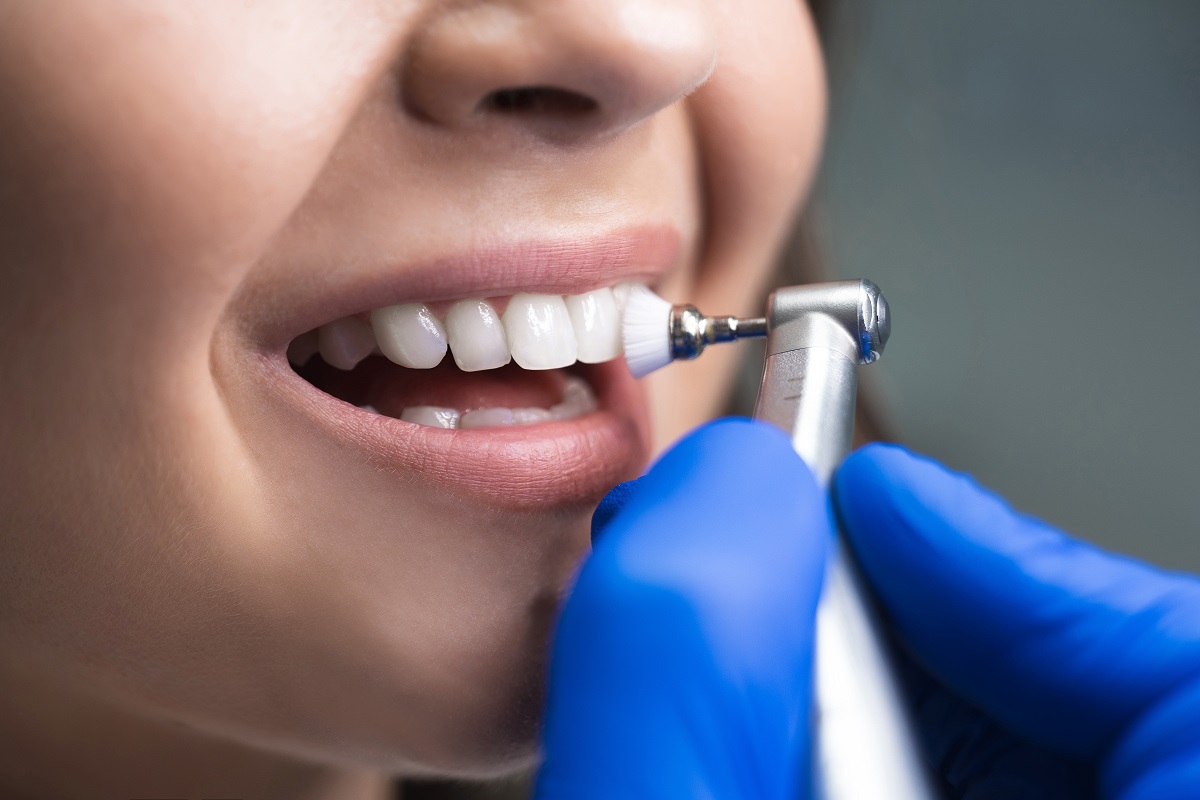 Possible Risks of Not Getting a Teeth Cleaning