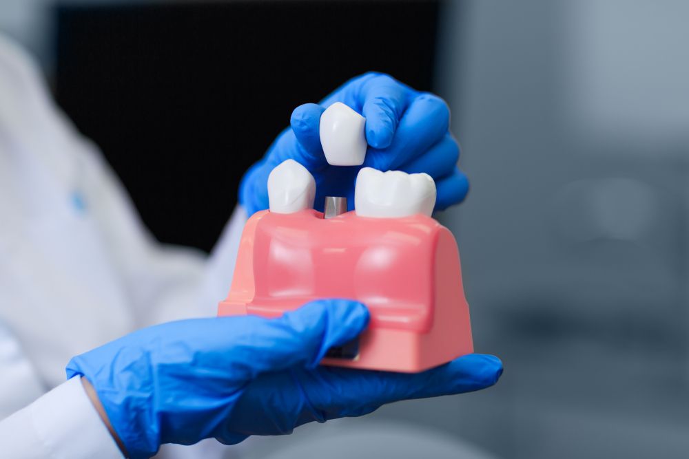 plase teeth