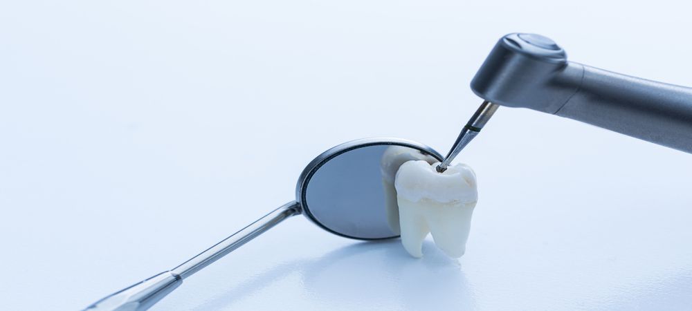 teeth filling