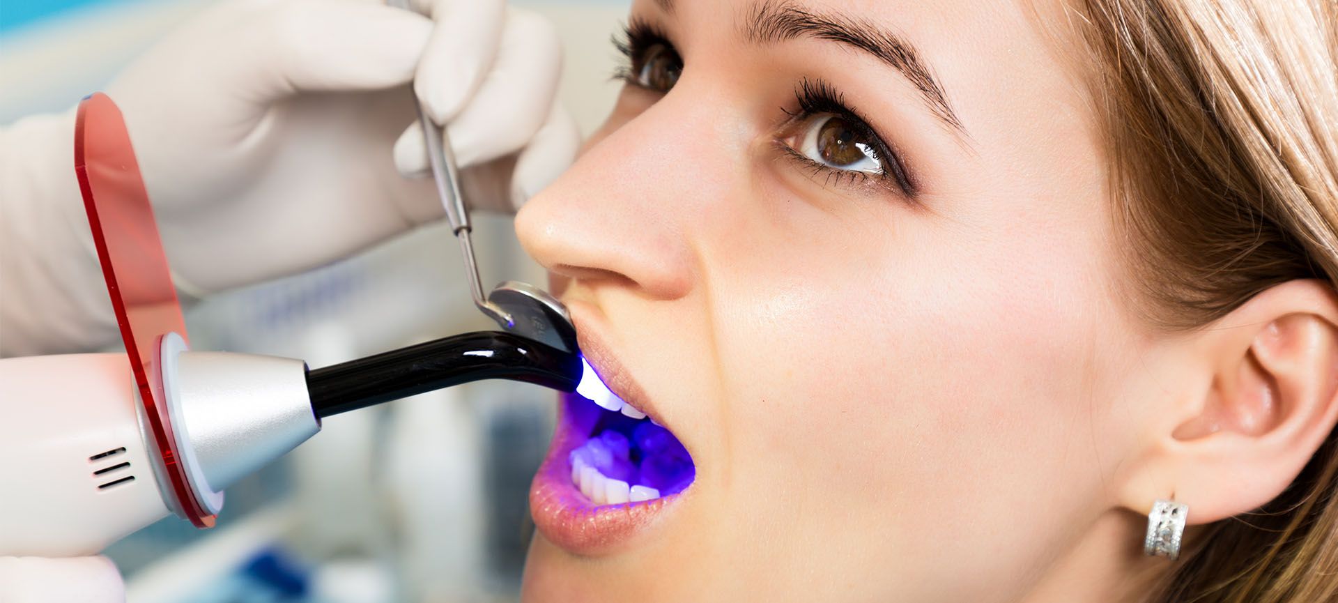 types of tooth