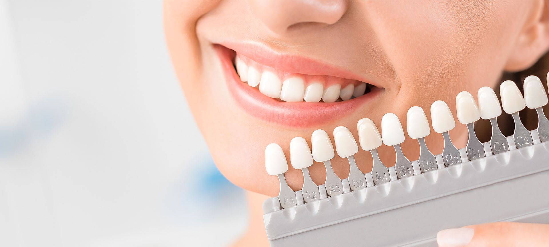 teeth whitening at the dentist