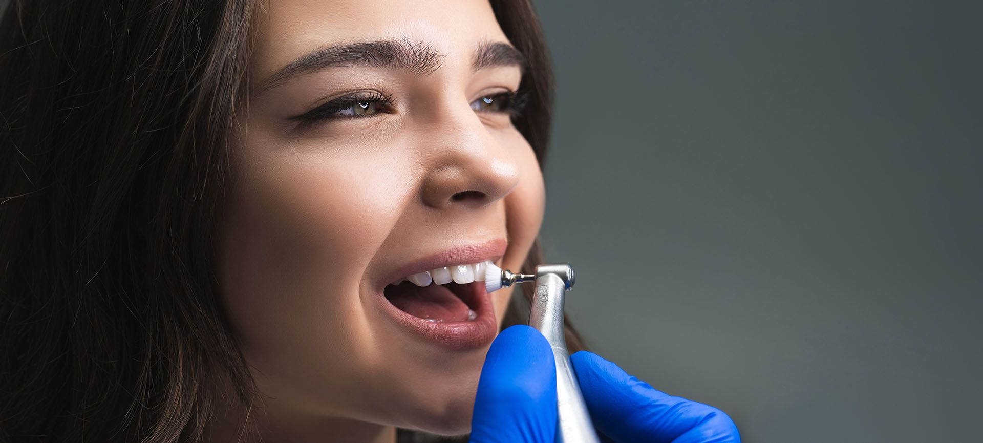 teeth cleaning without insurance