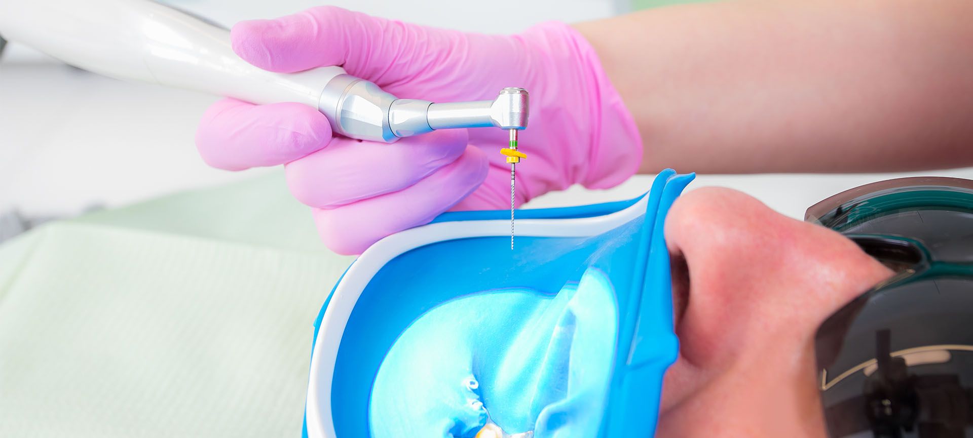 root canal treatment