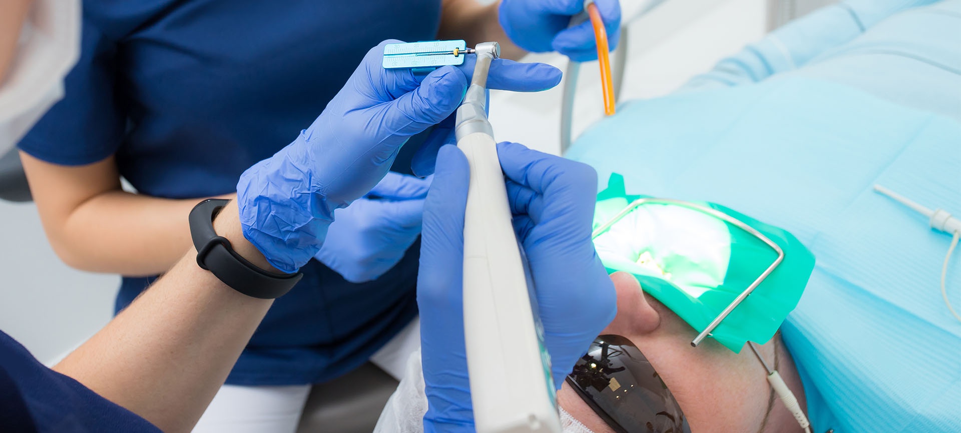 cost of root canal surgery