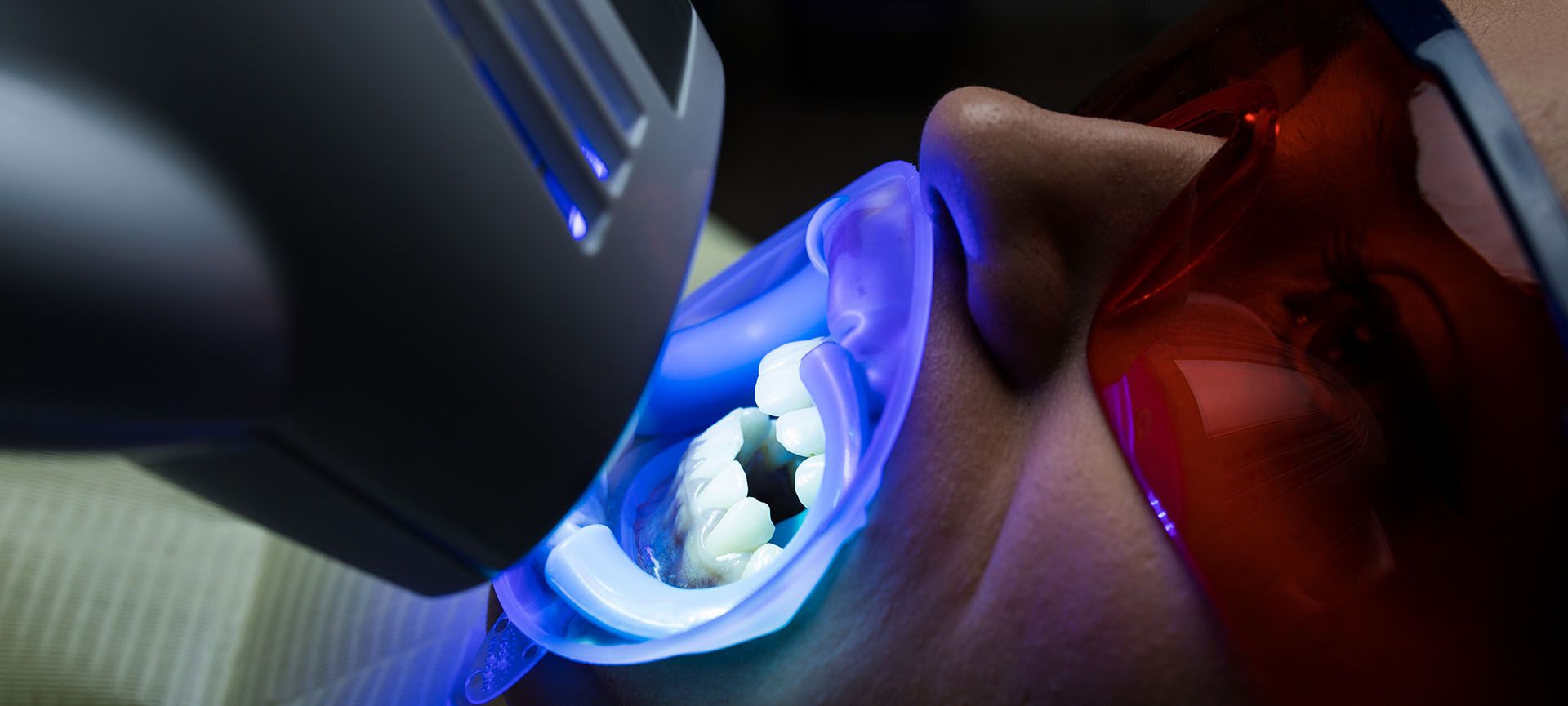 teeth whitening cost