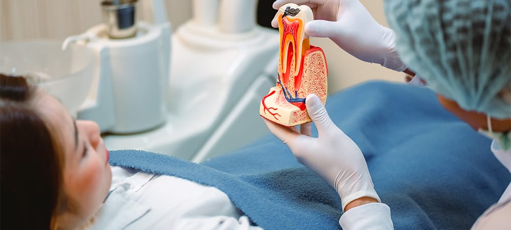 root canal recovery