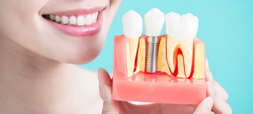 benefits of implant dentures