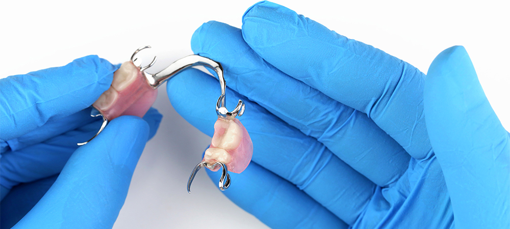removable partial dentures