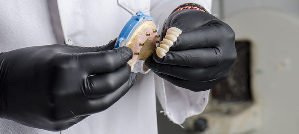 dental technician holding a monolithic zirconia restorations full arch implant supported with the ceramic load