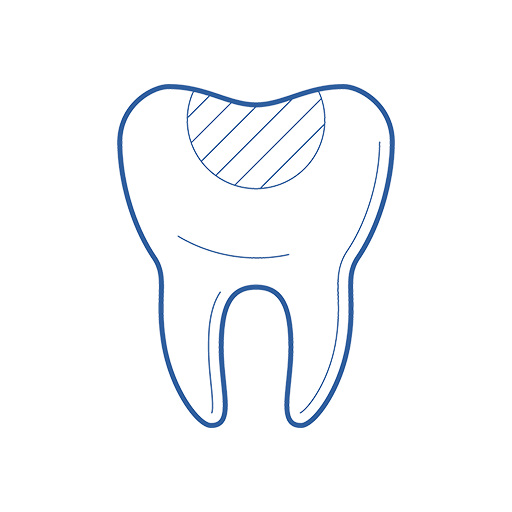 teeth fillings & restorations