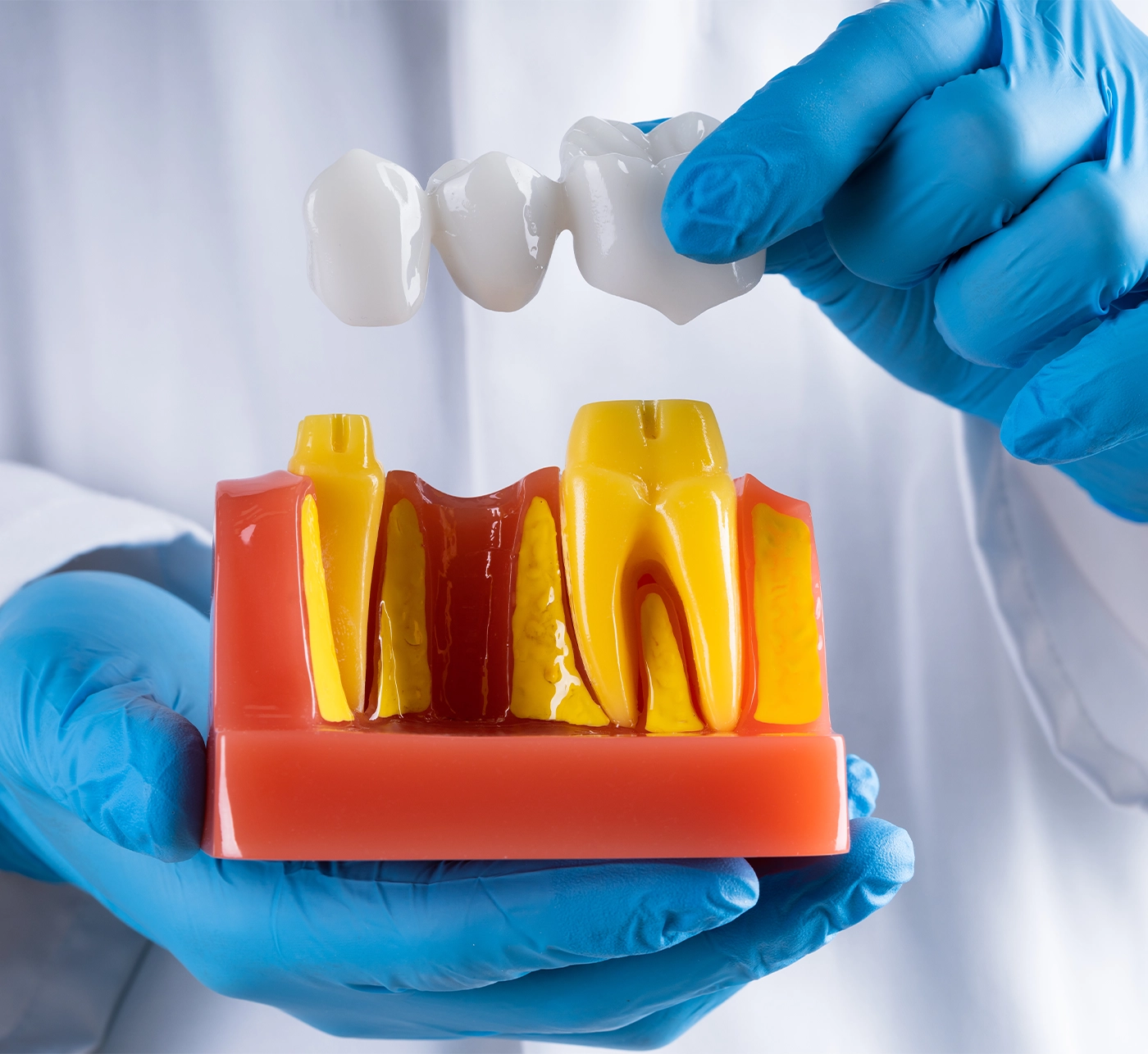 Dentist In Gloves Showing Dental Tooth Bridge Model